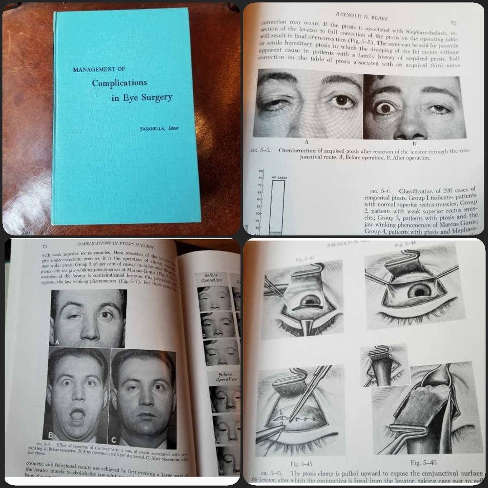 Vintage Eye Surgery medical book Management of Complications Fasanella
